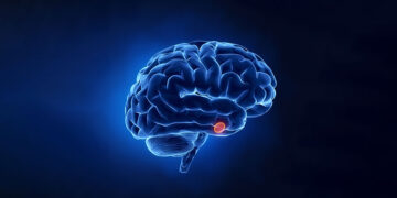 Beyincik Sarkması Nedir? Nasıl Tespit Edilir?