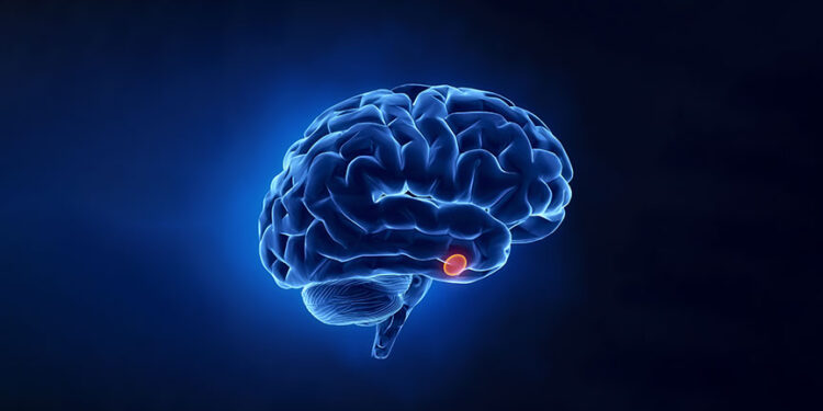 Beyincik Sarkması Nedir? Nasıl Tespit Edilir?