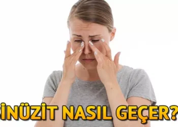 Sinüzit Nedir, Nasıl Geçer?
