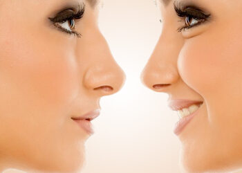 Burun Ameliyatı Sonrası Beslenme Nasıl Olmalıdır?