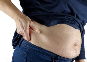 Liposuction